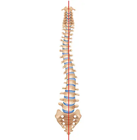 Una imagen de la columna vertebral con escoliosis